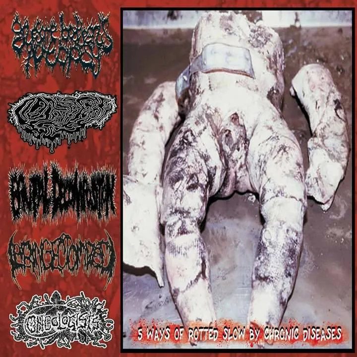 5 Ways of Rotted Slow by Chronic Diseases cover