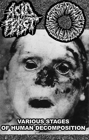 Various Stages of Human Decomposition cover