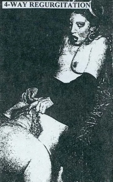 4-Way Regurgitation cover