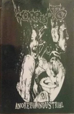 Anorexia Industrial cover