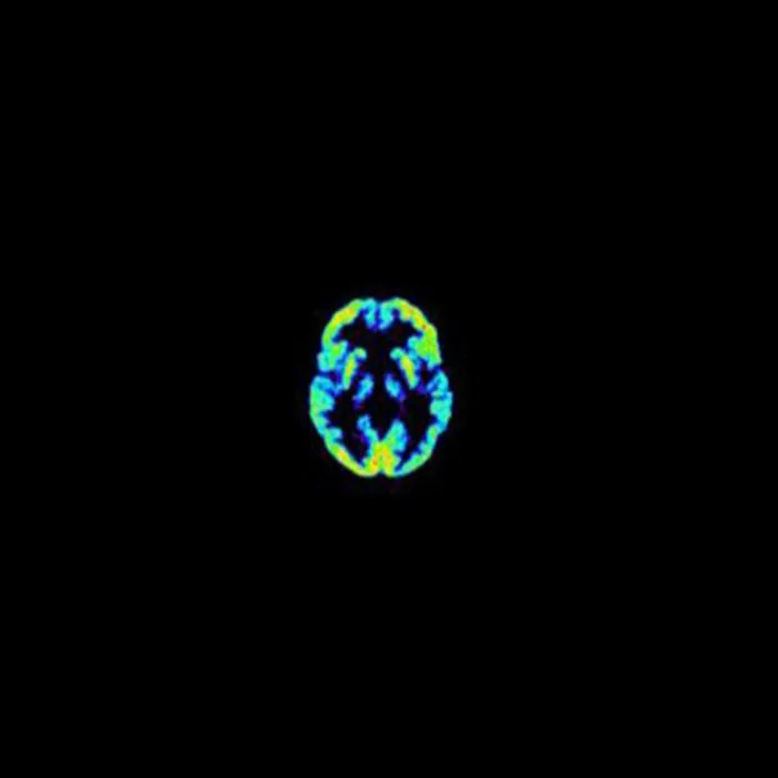 Psyche cover
