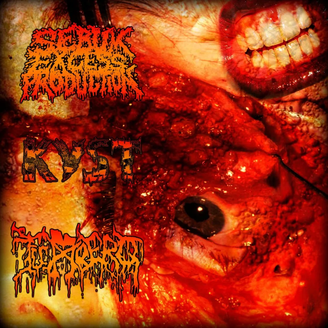 Sebum Excess Production / Kyst / Tumbero cover