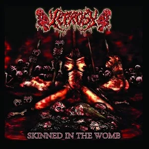 Skinned in the Womb cover