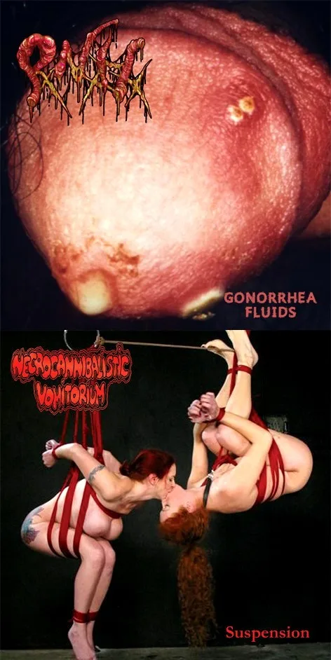 Gonorrhea Fluids / Suspension cover