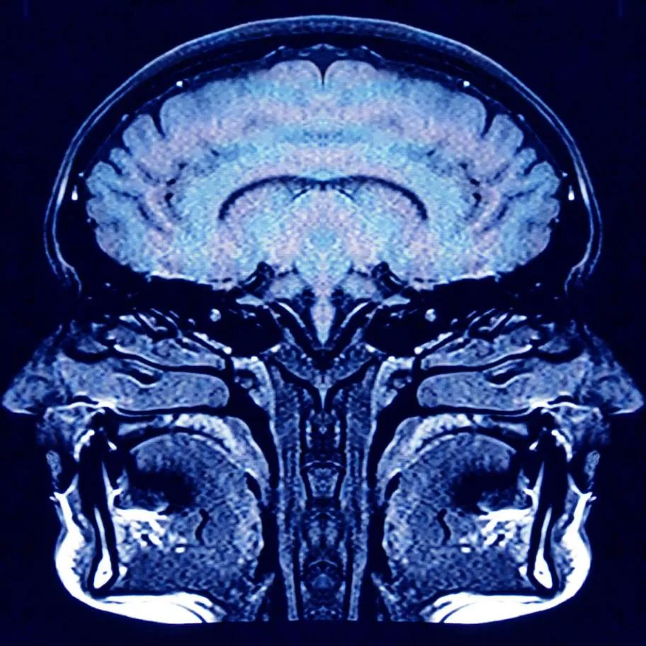 Consciousness Haze cover