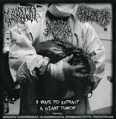 3 Ways to Extract a Giant Tumor cover