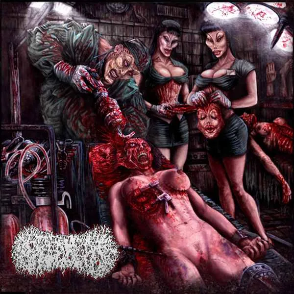 Surgical Excoriation cover