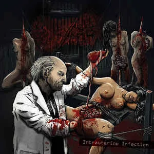 Intrauterine Infection cover