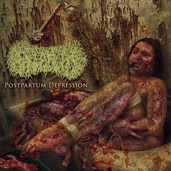 Postpartum Depression cover