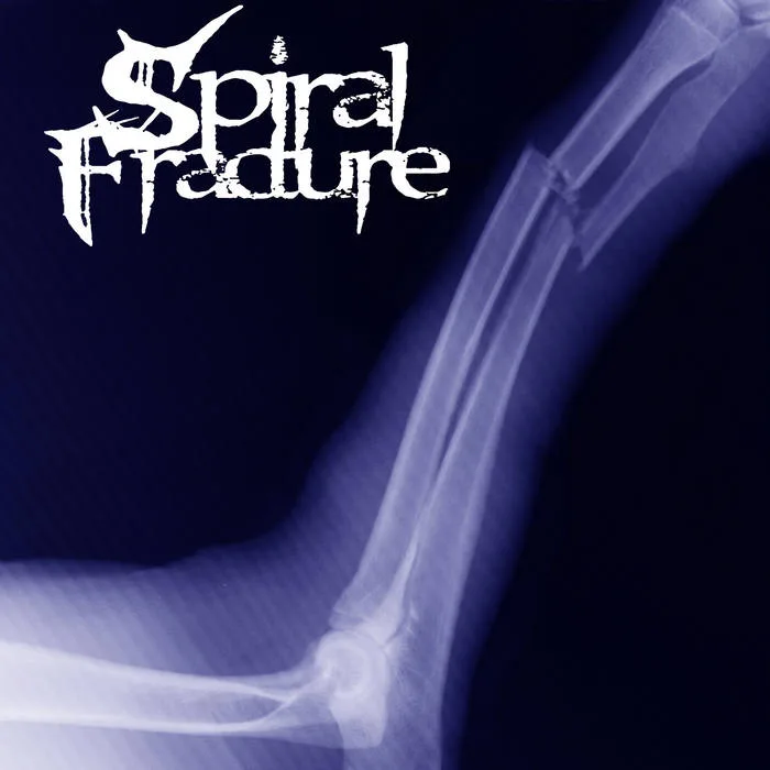 Spiral Fracture cover