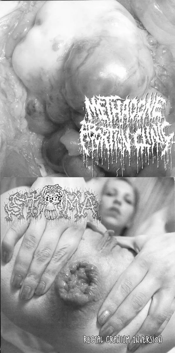 Methadone Abortion Clinic / Rectal Cranium Inversion cover