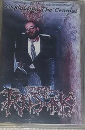 Exploiding the Cranial cover