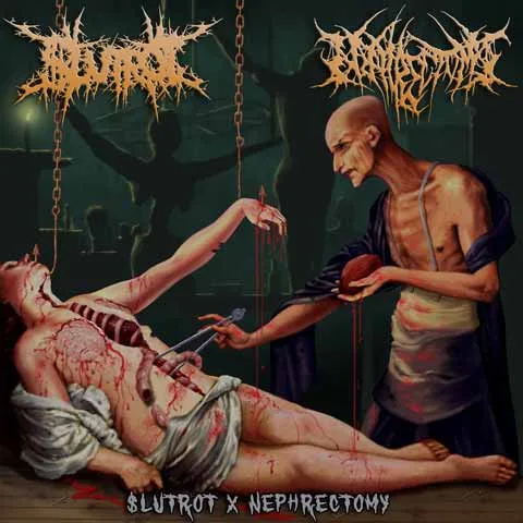 $lutrot x Nephrectomy cover