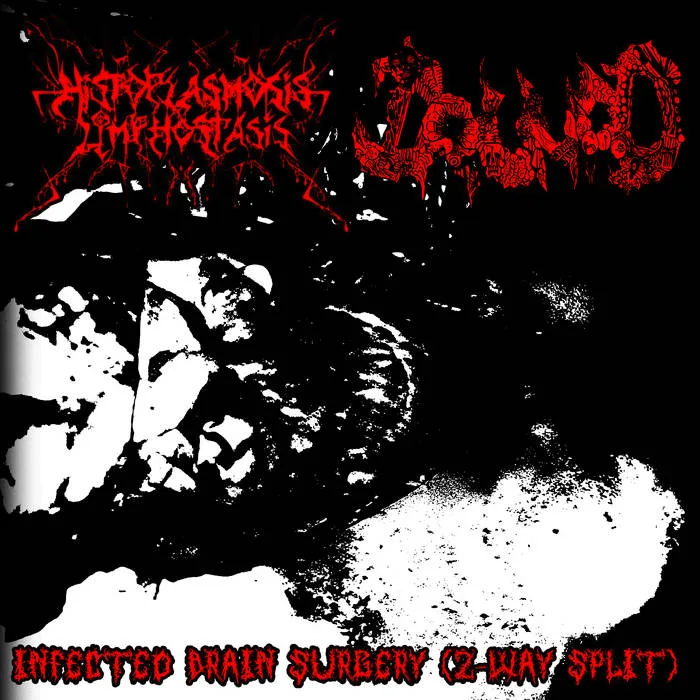 Infected Brain Surgery (2-Way Split) cover