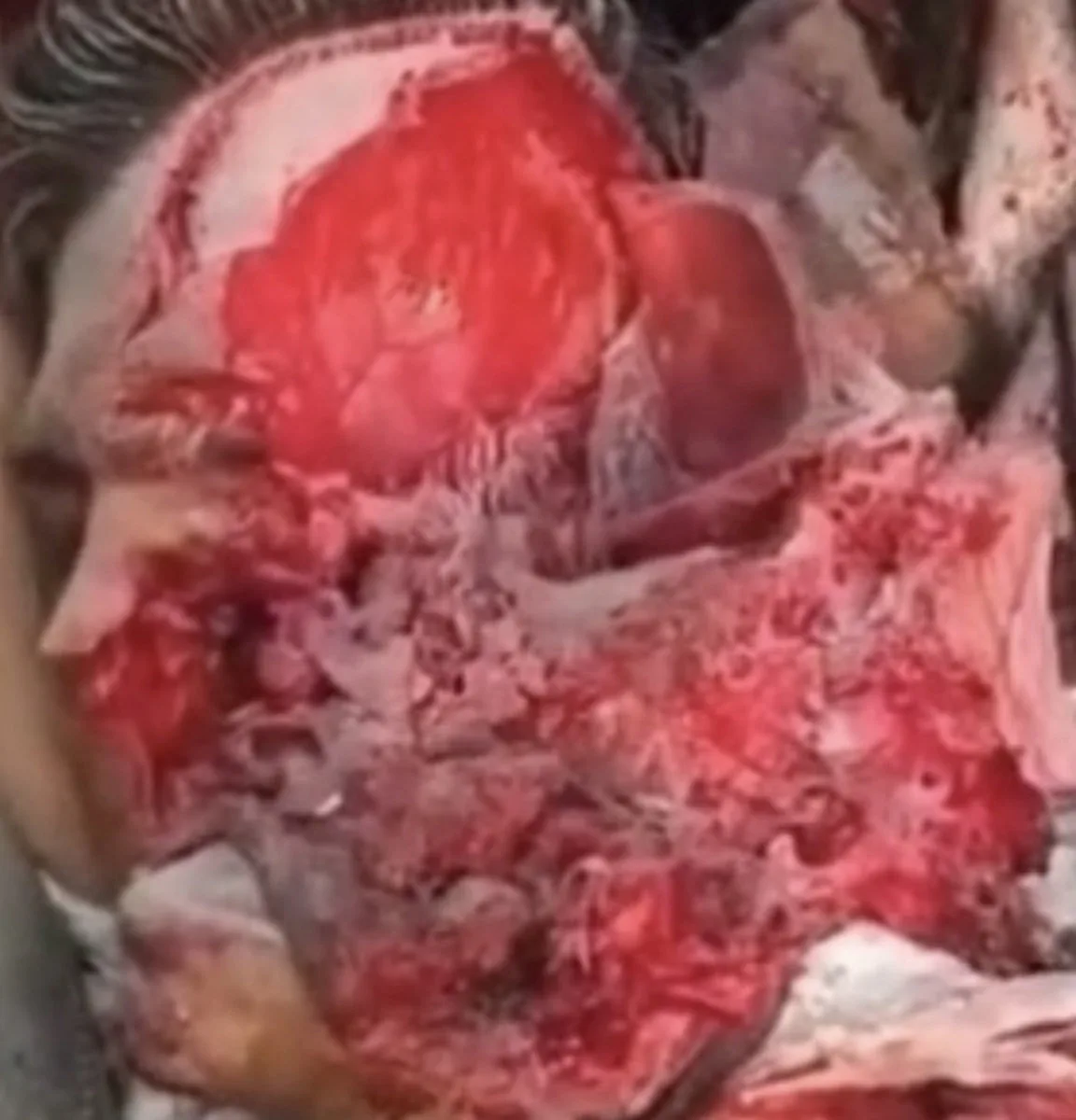 Carcass Mastication cover