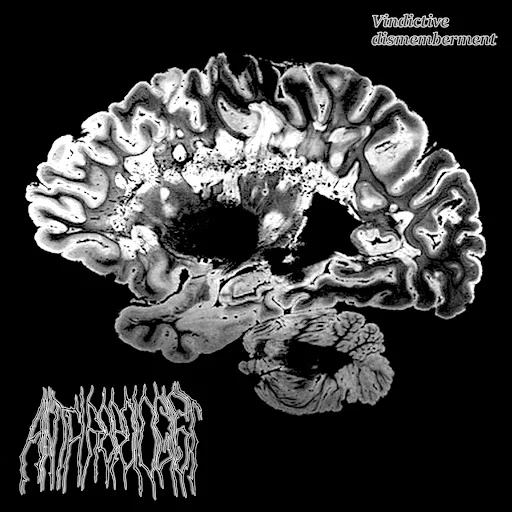 Vindictive Dismemberment cover