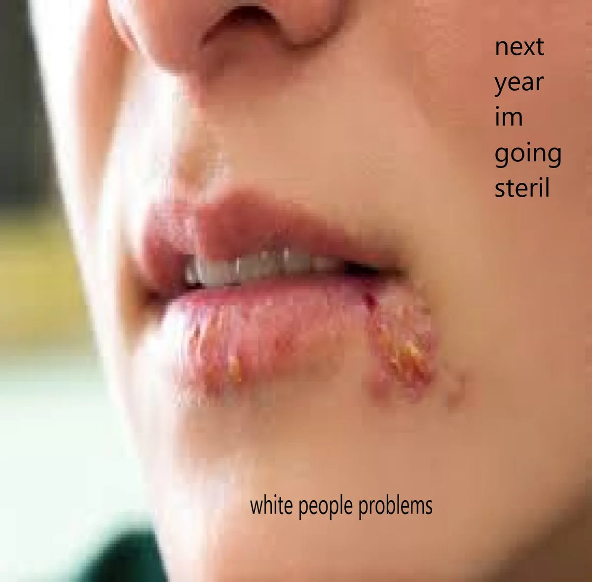 Oh Yeah You Gave Everyone Herpes !​!​! cover