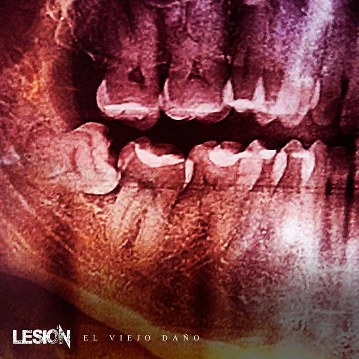 El viejo da​ñ​o cover