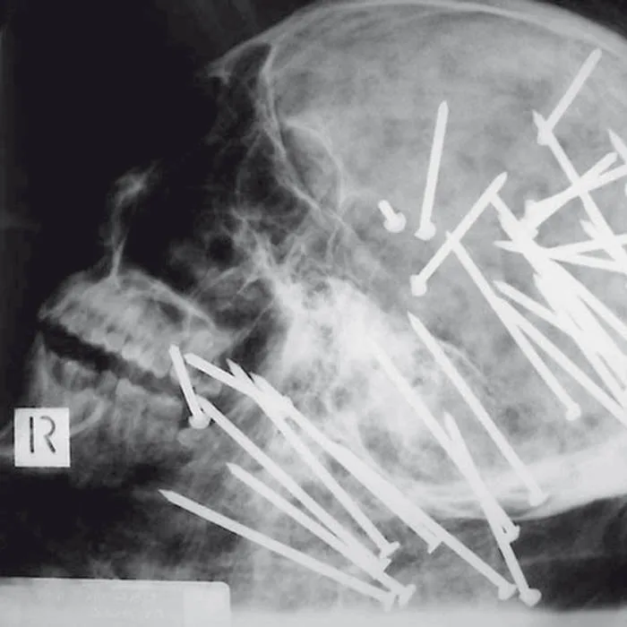 Visceral Anomalies cover