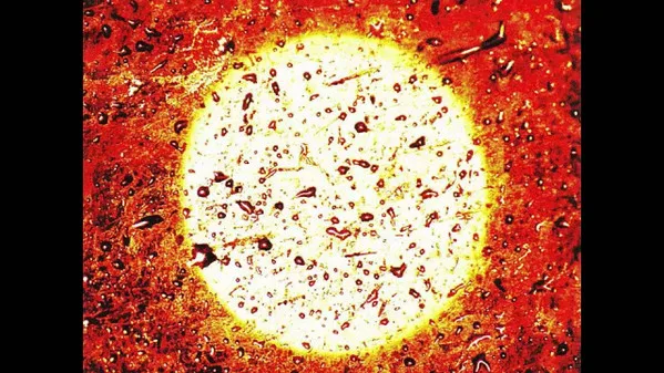 The Massacrista cover