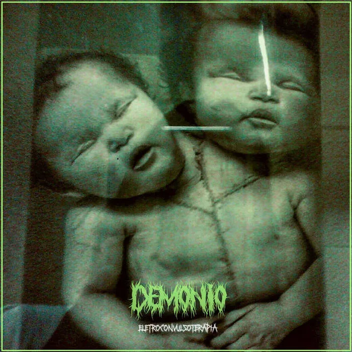 Eletroconvulsoterapia cover