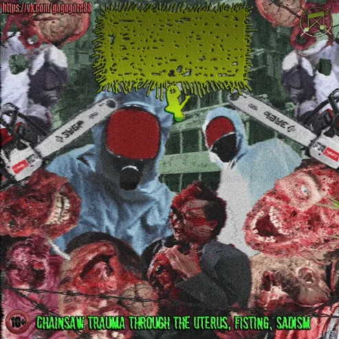 Chainsaw Trauma Through the Uterus, Fisting, Sadism cover