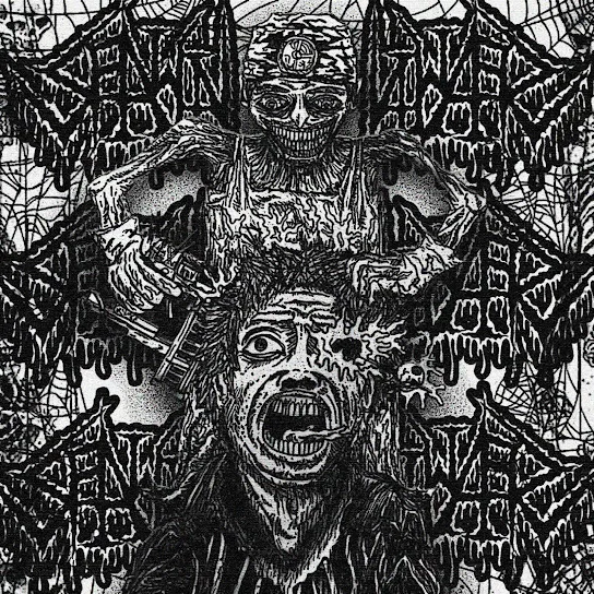 Nailgun Lobotomy cover
