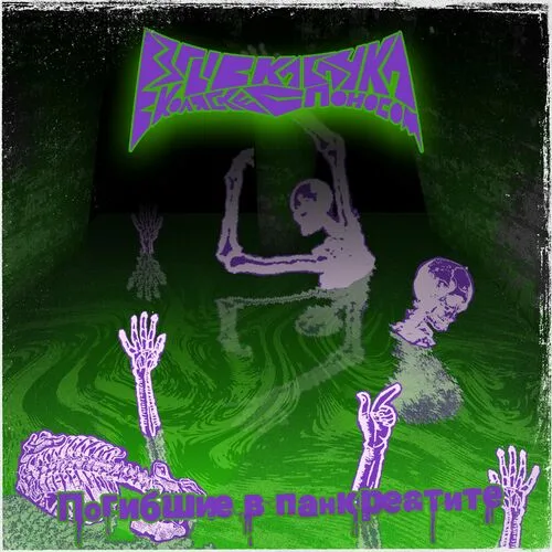 Погибшие в панкреатите cover