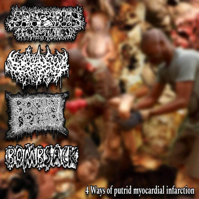 4 Ways of Putrid Myocardial Infarction cover
