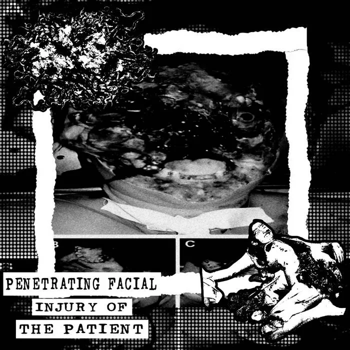 Penetrating Facial Injury of the Patient cover