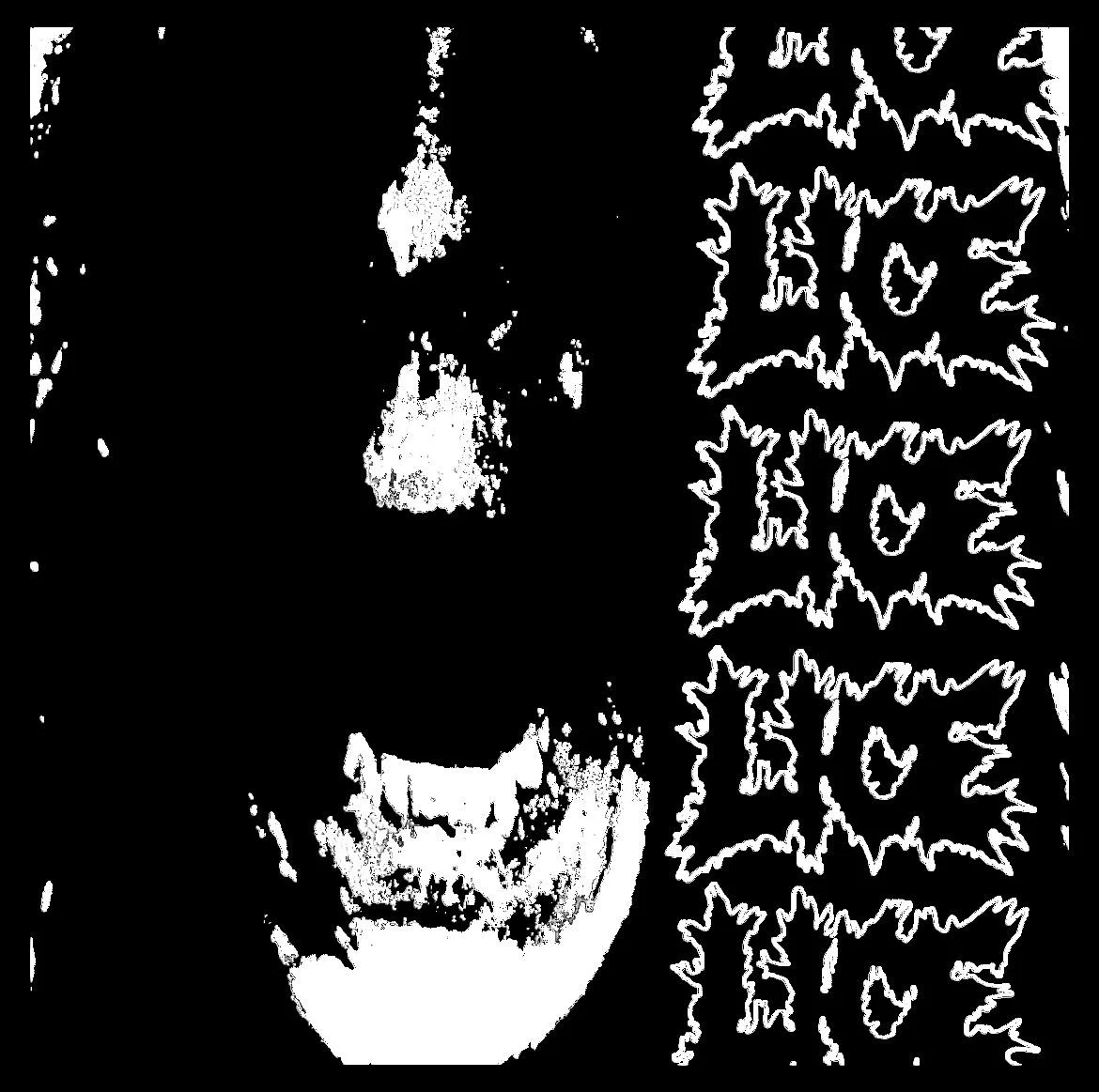 Overdose Demo cover