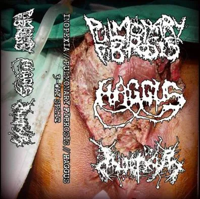 Inopexia // Pulmonary Fibrosis // Haggus 3-Way Split cover