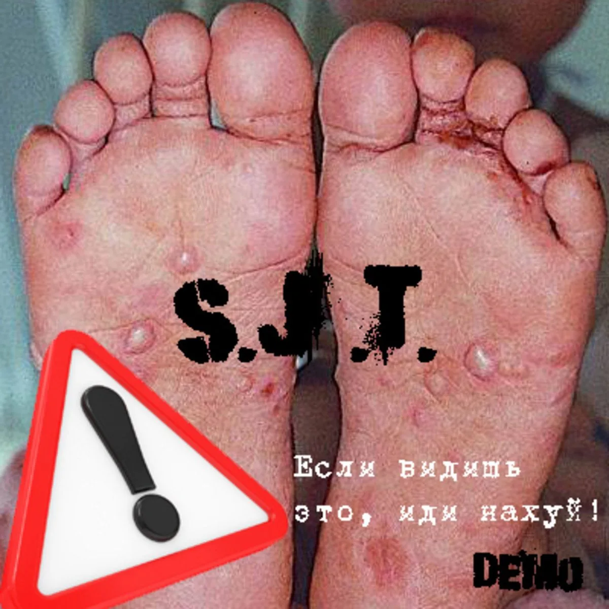 Demo cover