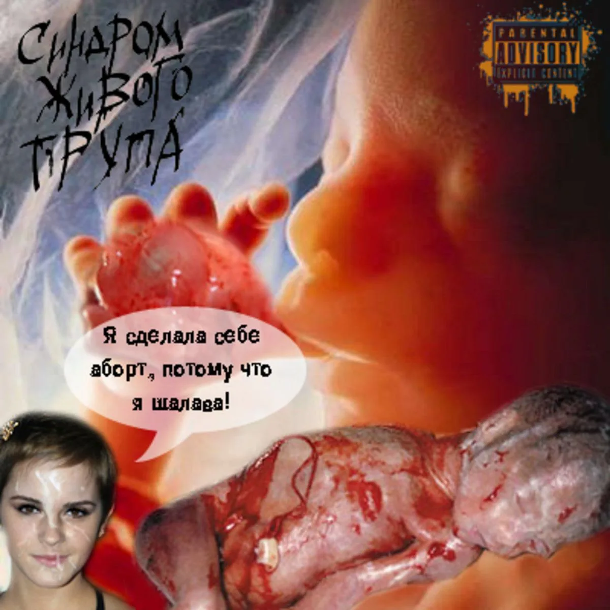 Я Сделала Себе Аборт Потому Что Я Шалава cover