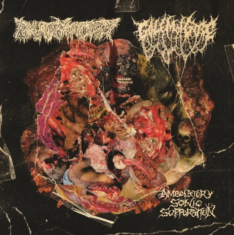 Ambulatory Sonic Suppuration cover