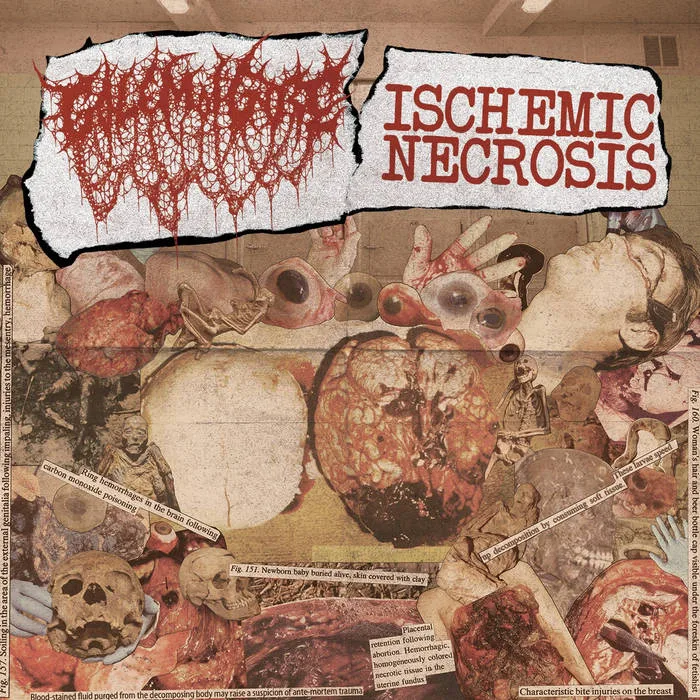 Ischemic Necrosis / Golem of Gore cover