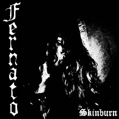 Skinburn cover