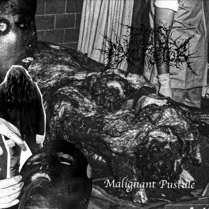 Malignant Pustule cover