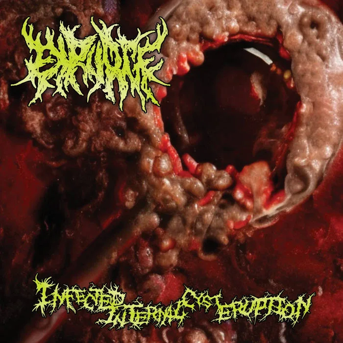 Infected Internal Cyst Eruption cover