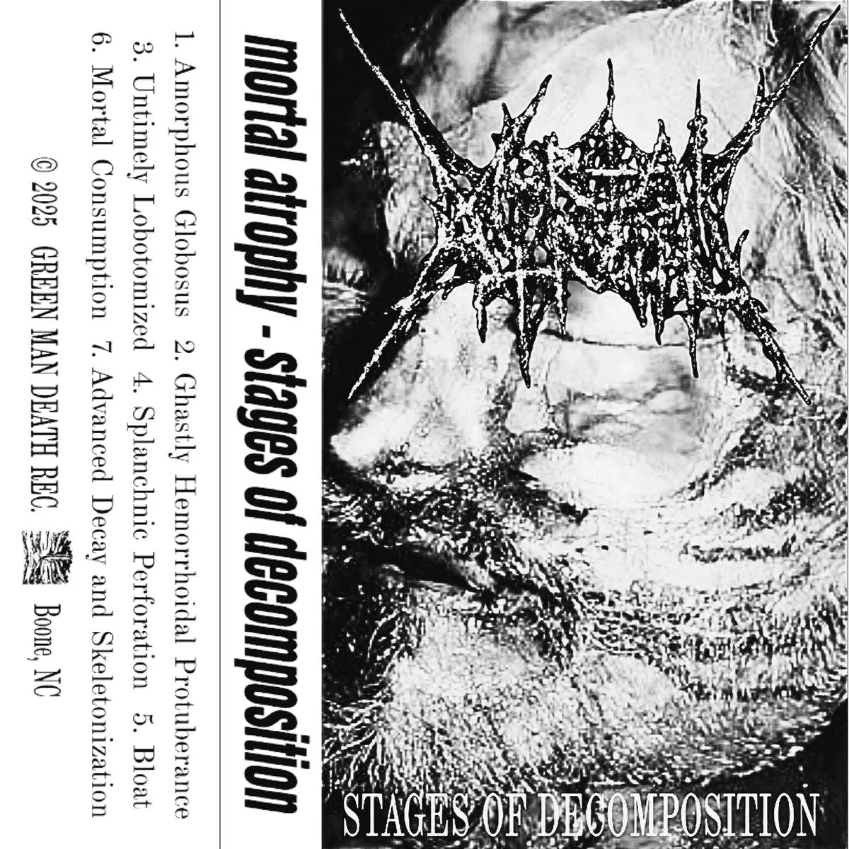 Stages of Decomposition cover