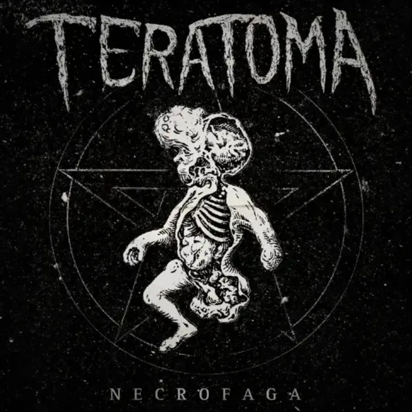 Teratoma cover