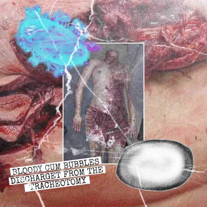 Bloody Cum Bubbles Discharget from the Tracheotomy cover