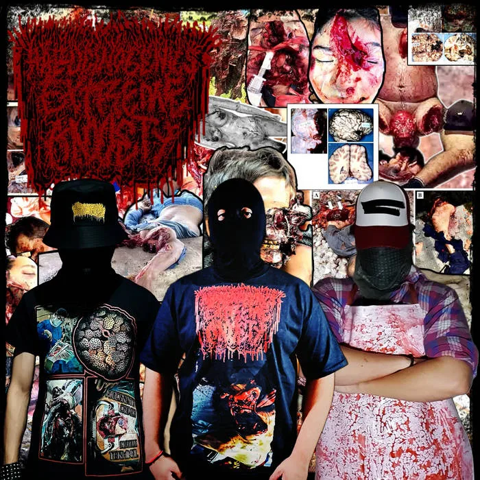 Hallucinogenics Extreme Anxiety - Miocarditis Cronica Dilatada Terminal cover