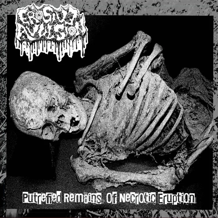 Putrefied Remains of Necrotic Eruption cover
