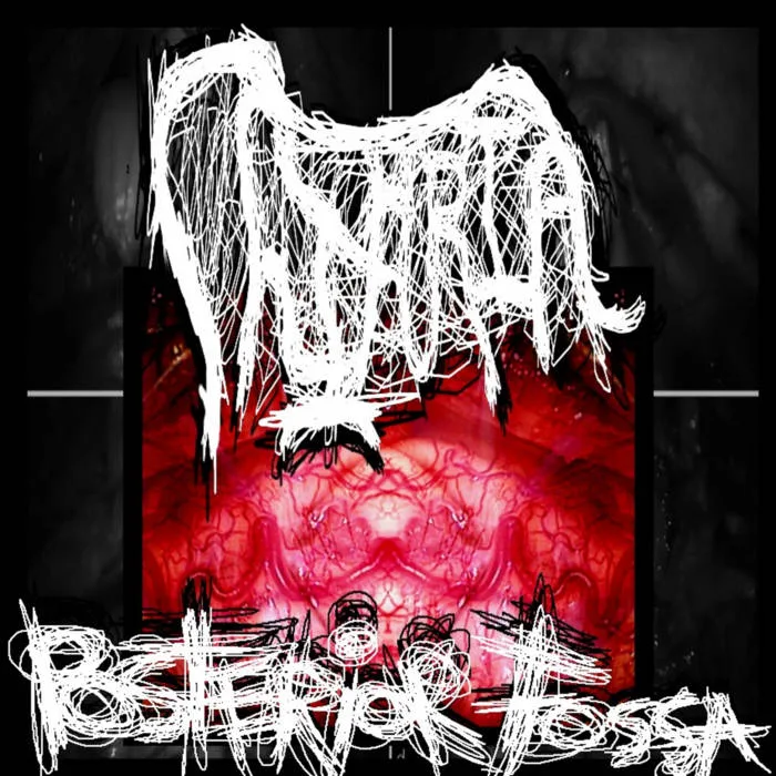 Posterior Fossa cover