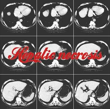 Hepatic Necrosis cover