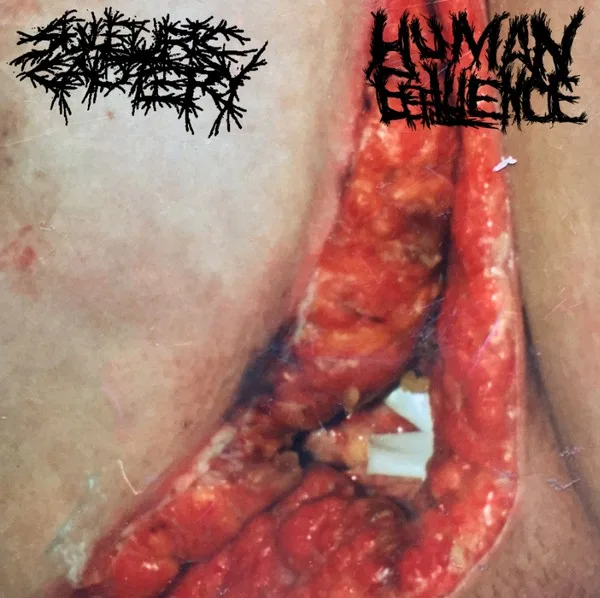 Sulfuric Cautery / Human Effluence cover