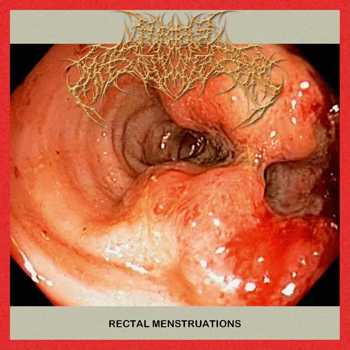 Rectal Menstruations cover