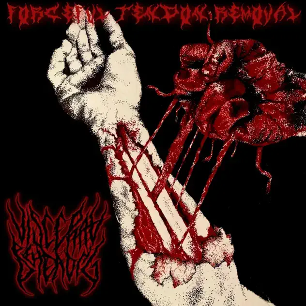 Forceful Tendon Removal cover