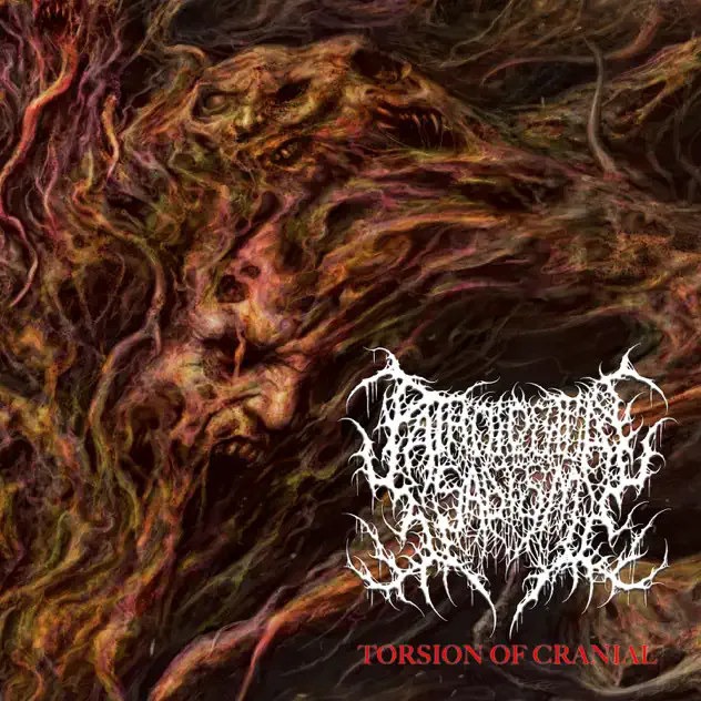 Torsion of Cranial cover